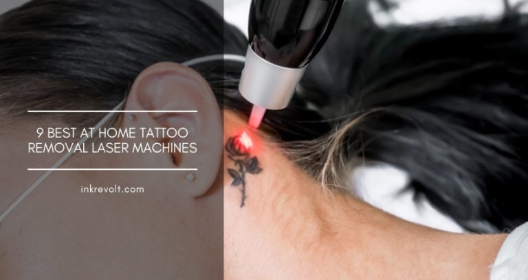 9 Best At Home Tattoo Removal Laser Machines: Reviews And Buyer’s Guide