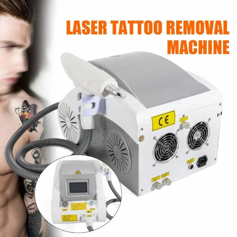 Top 9 Best At Home Tattoo Removal Laser Machines In 2023