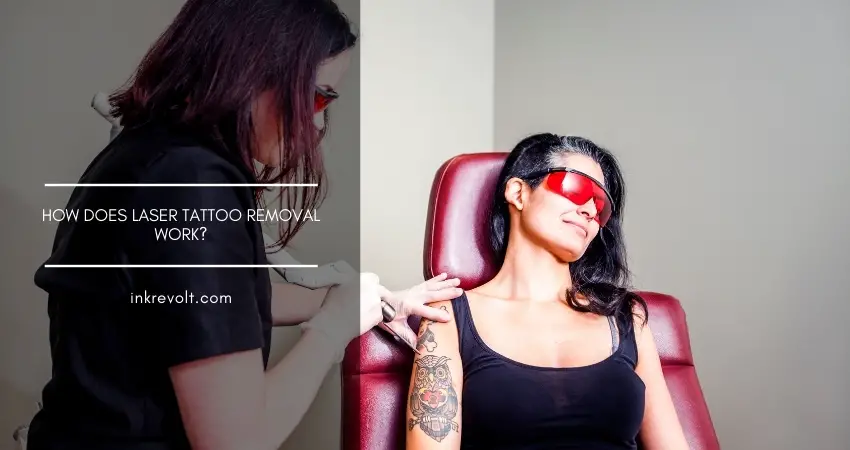 How Does Laser Tattoo Removal Work?