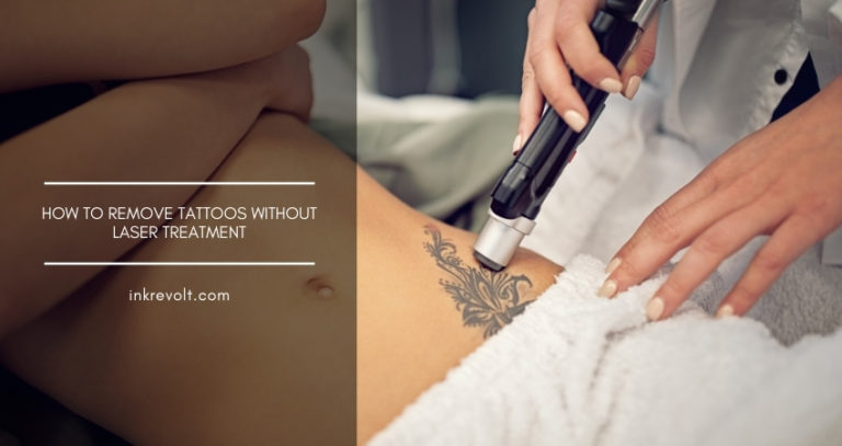 How To Remove Tattoos Without Laser Treatment: Pros & Cons