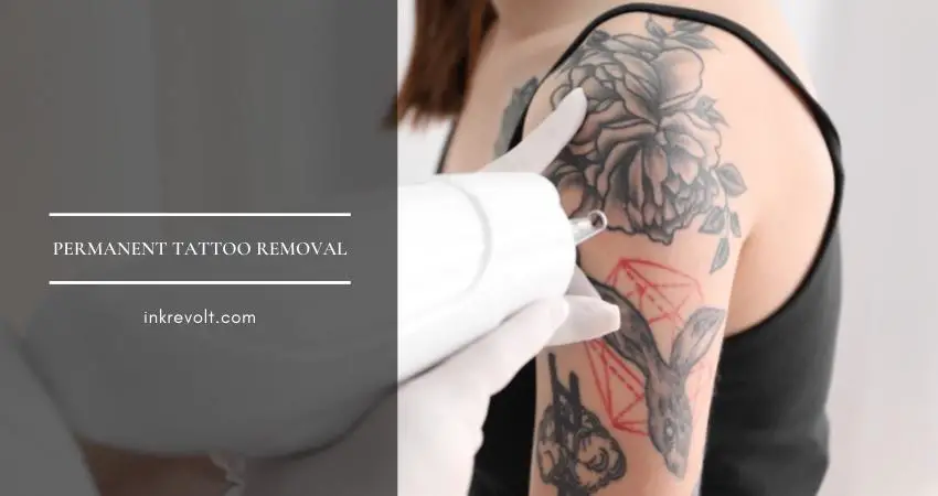 permanent tattoo removal
