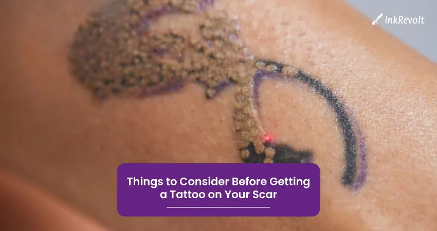 Things to Consider Before Getting a Tattoo on Your Scar
